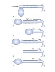 نمونه سوالات پرومتریک بیهوشی
