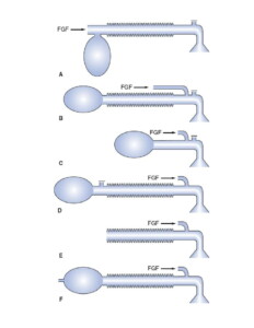 نمونه سوالات پرومتریک بیهوشی